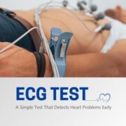 ECG Test