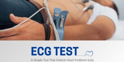 ECG Test