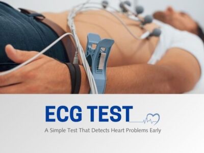 ECG Test